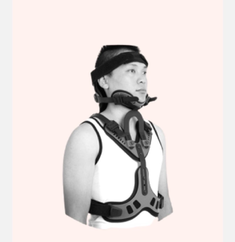 Cervico-Thoracic Orthosis (CTO)