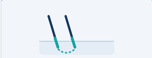 Two electrodes, bipolar configuration
